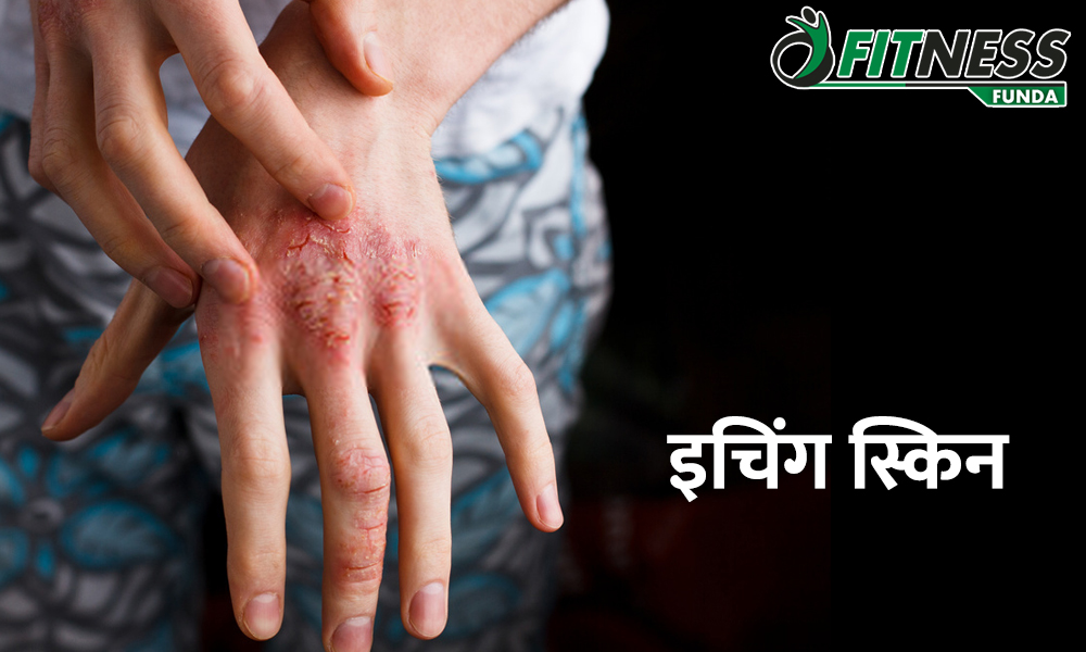 Home Remedies Overcome Itching In Just 7 Days