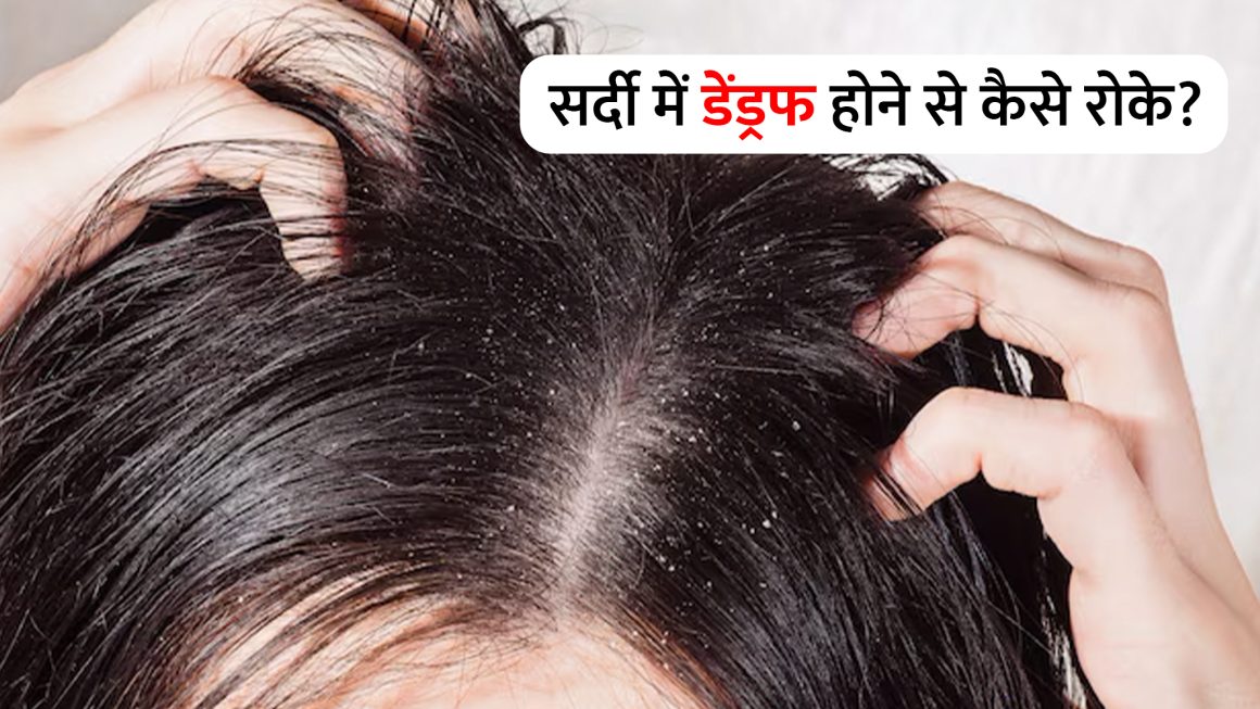 डैंड्रफ होने पर बालों को कितनी बार धोना चाहिए? जानिए सर्दियों में डैंड्रफ से छुटकारा कैसे पाएं!